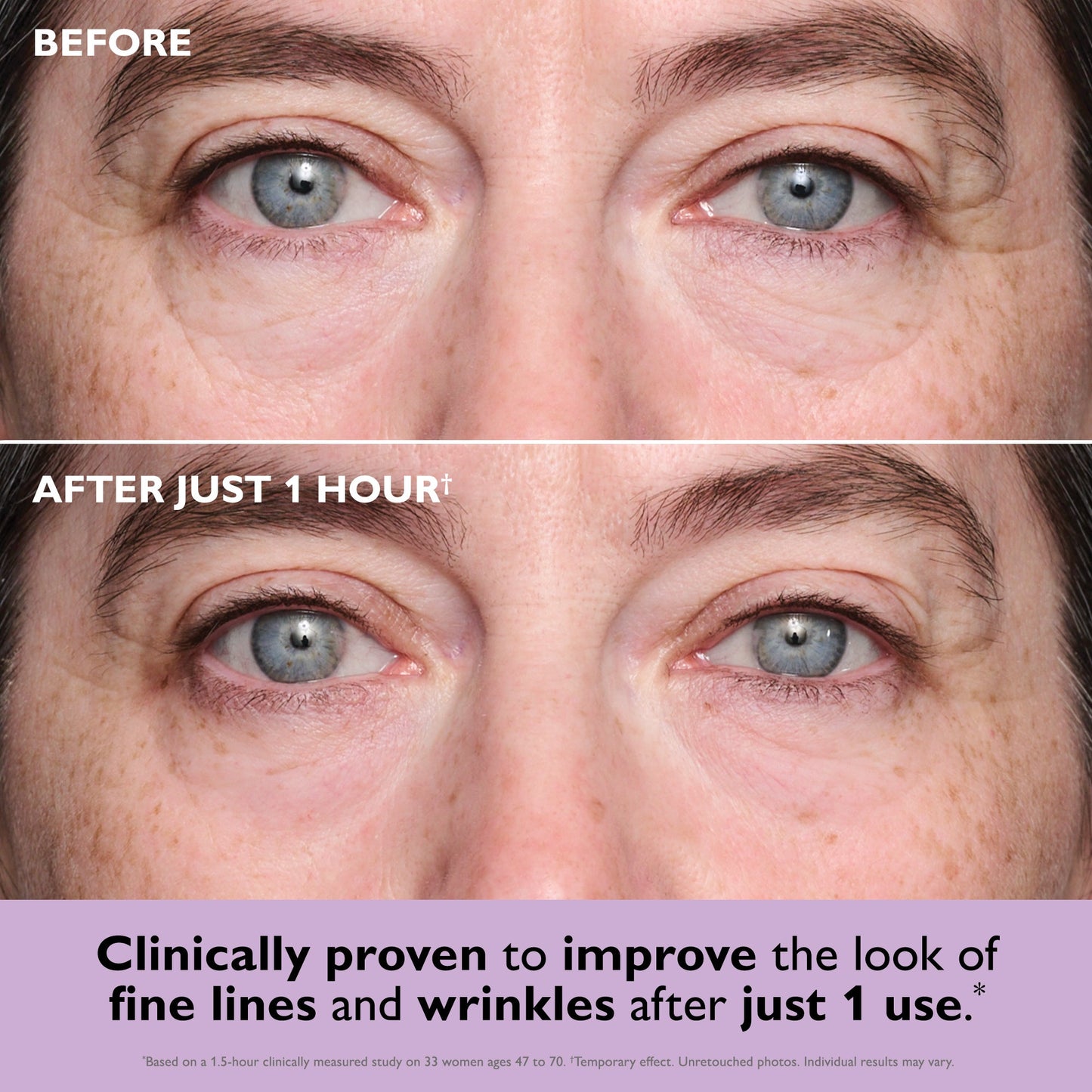 COLLAGEN INFUSION TIGHTENING EYE PATCHES